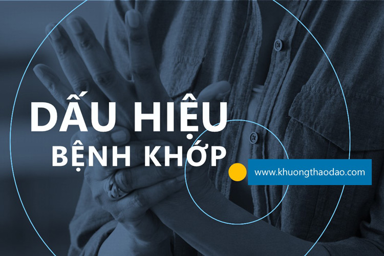 Cảnh báo sớm: Các dấu hiệu bệnh khớp cần lưu ý