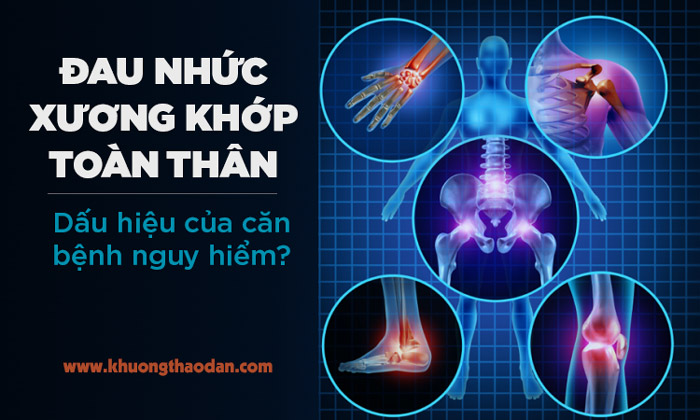 Đau nhức xương khớp toàn thân là bệnh gì? Nguyên nhân và cách điều trị