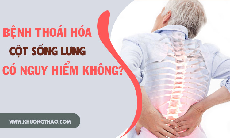 Thoái hóa cột sống lưng có nguy hiểm không?