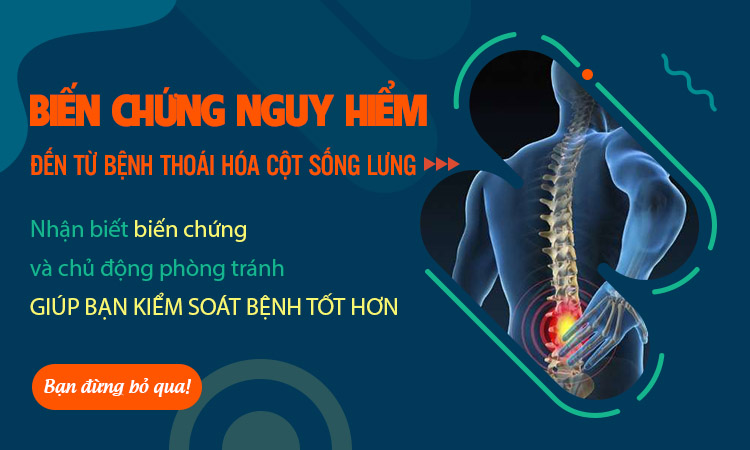 Thoái hóa cột sống lưng để lại những biến chứng nguy hiểm gì?