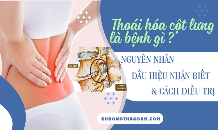 Thoái hóa cột sống lưng là gì