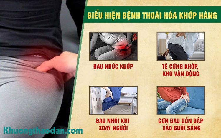 Biểu hiện bệnh thoái hoá khớp háng