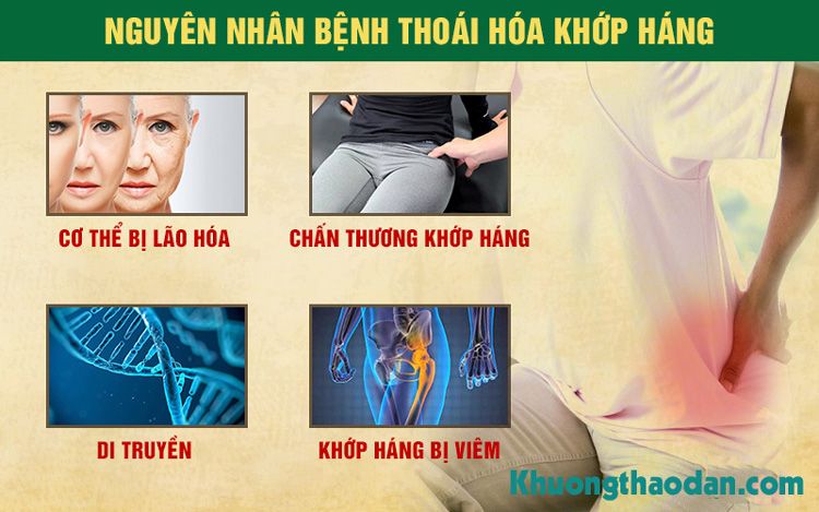 Nguyên nhân gây bệnh thoái hóa khớp háng