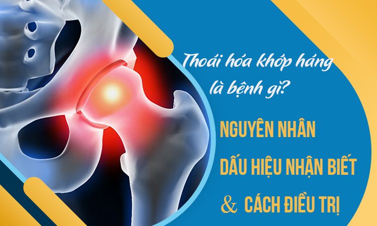 Thoái hóa khớp háng là gì? Những điều cần biết về bệnh thoái hóa khớp háng