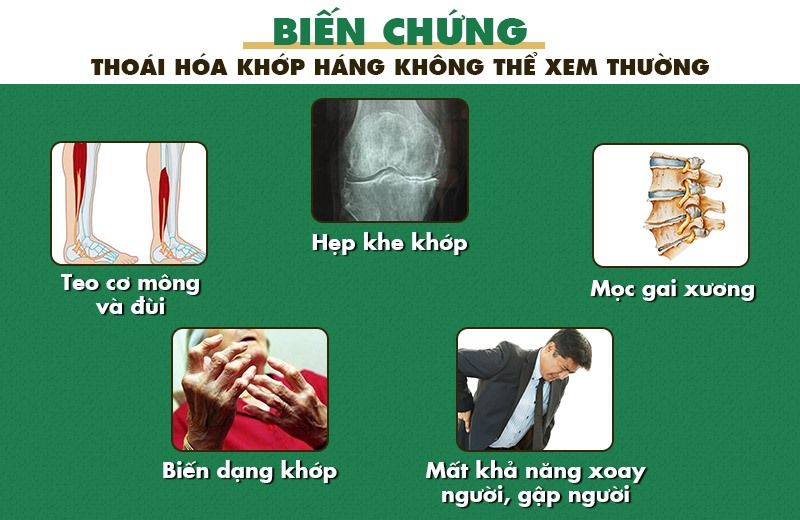 Biến chứng của thoái hóa khớp háng