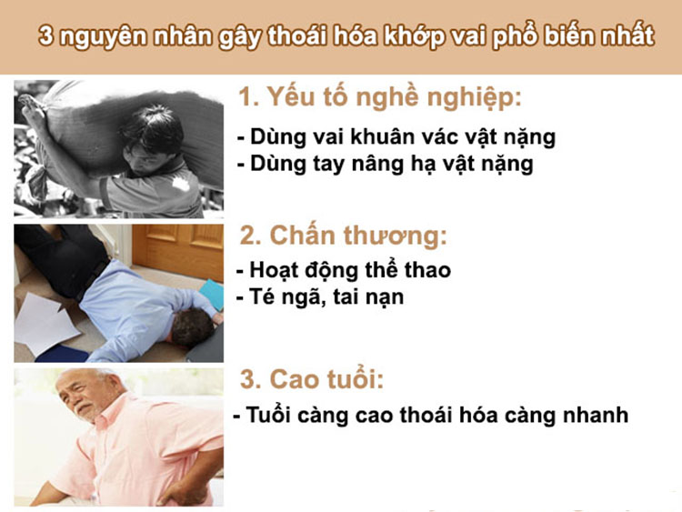 Nguyên nhân thoái hóa