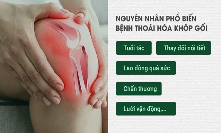 Nguyên nhân thoái hóa khớp gối và cách cải thiện bệnh tại nhà