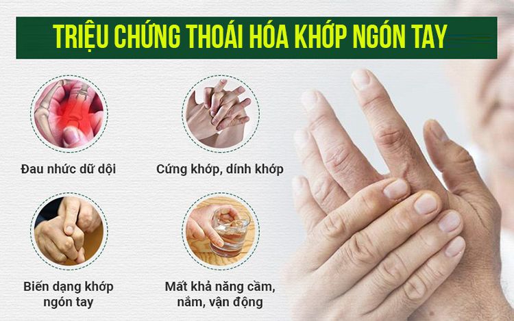 Triệu chứng thoái hoá khớp ngón tay