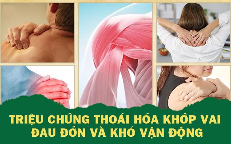 Triệu chứng và dấu hiệu