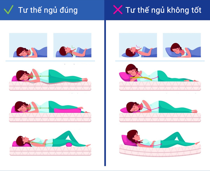 Tư thế ngủ đúng giúp phòng tránh đau khớp vai, cổ, gáy (Ảnh minh họa)