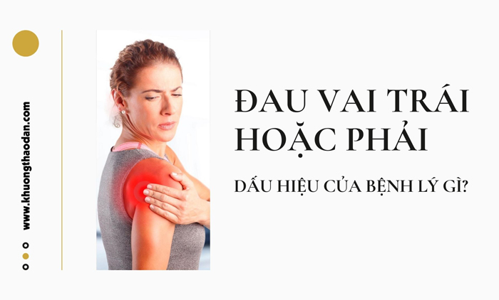 Đau bả vai trái hoặc phải có thể là bệnh lý gì? Điều trị thế nào?