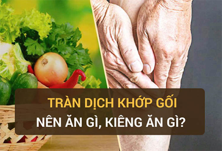 Tràn dịch khớp gối: Nên ăn gì, Kiêng ăn gì?