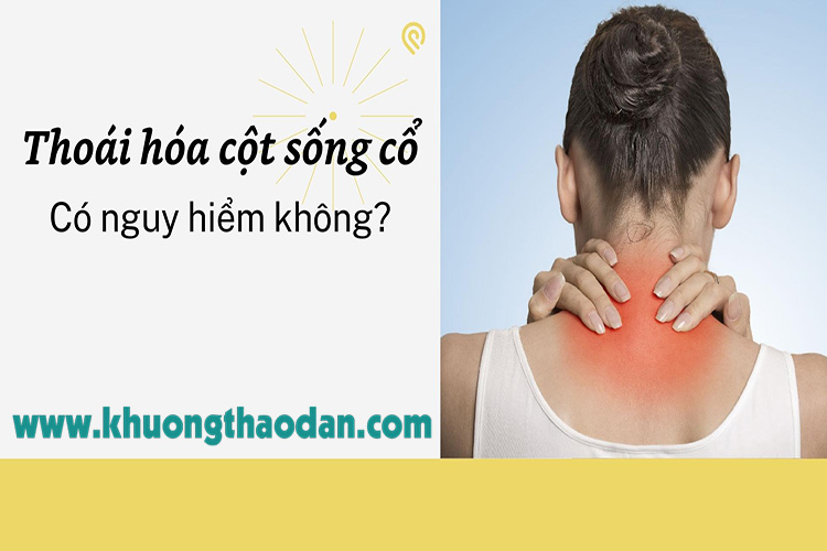 [Giải đáp] Bệnh thoái hóa cột sống cổ có nguy hiểm không?