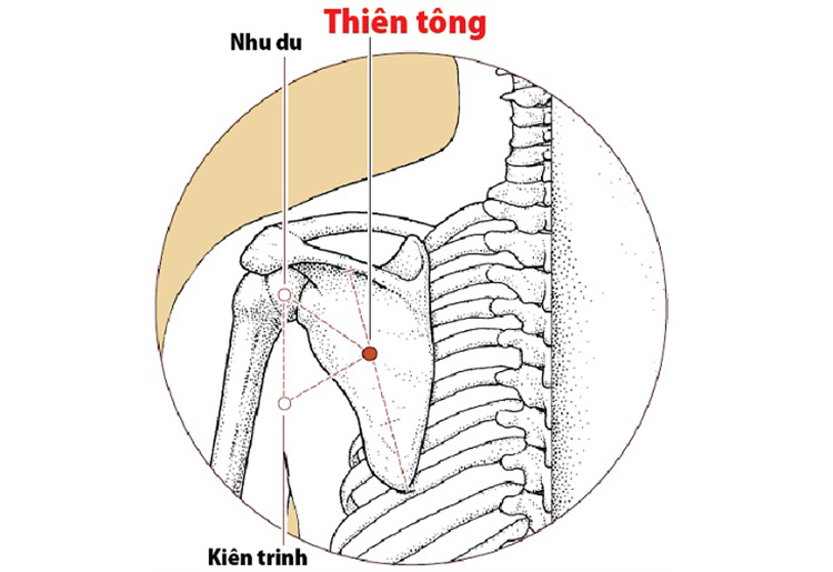 Huyet-Thien-tong